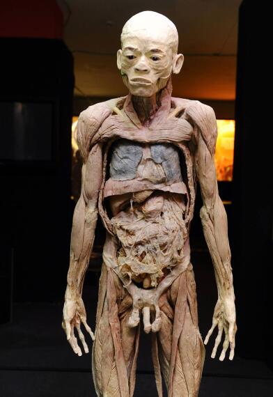La exposición Human Bodies llega a Murcia - LaVerdad.es. Foto 23 de 29