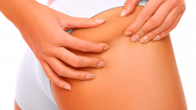 termolipólisis Reducción intensivo por 38 - Main Image